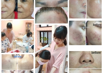 健康皮膚管理,皮膚管理,韓國MTS,mts皮膚管理課程,美容教學