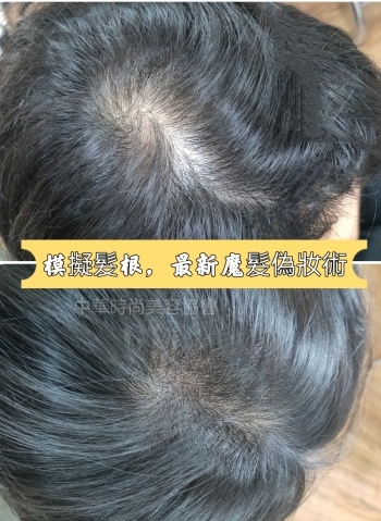 SMP頭皮紋髮